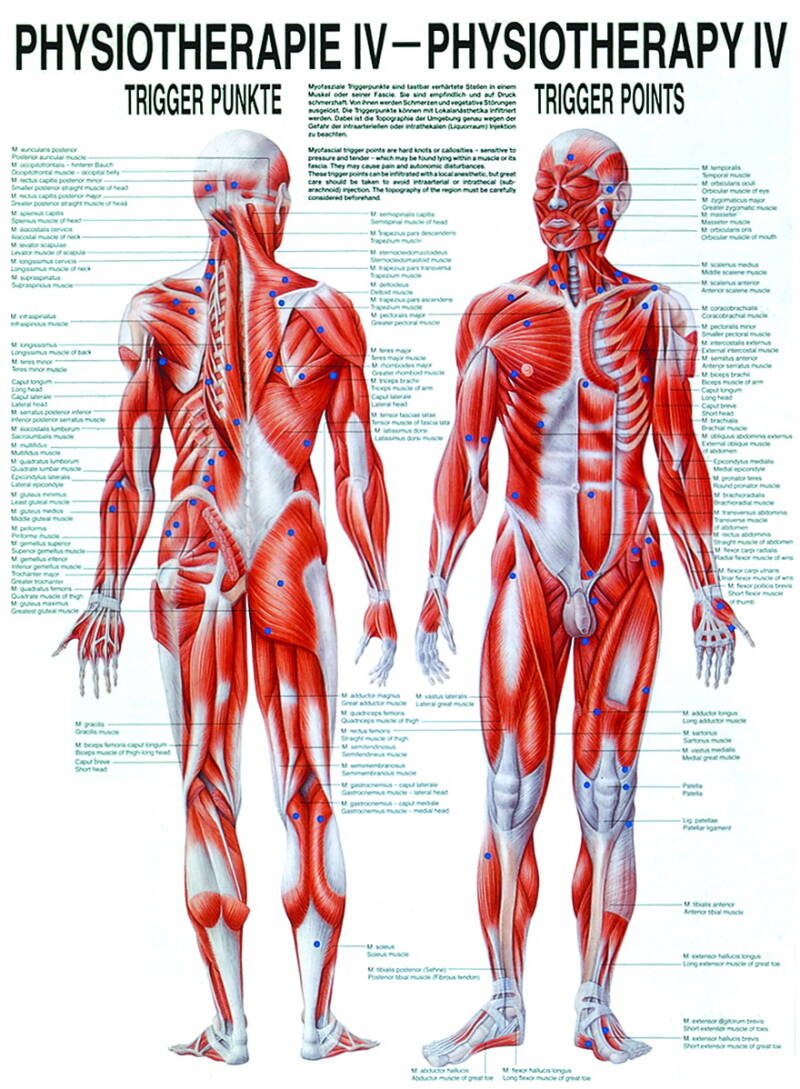 Lehrtafel, Physiotherapie IV, Trigger Punkte – Hauptansicht