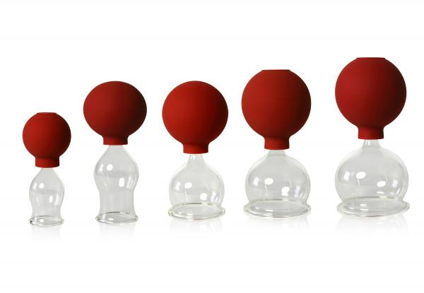 Schröpfgläser mit Saugball – Produktansicht 6