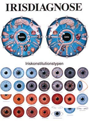 Lehrtafel, Irisdiagnose – Hauptansicht