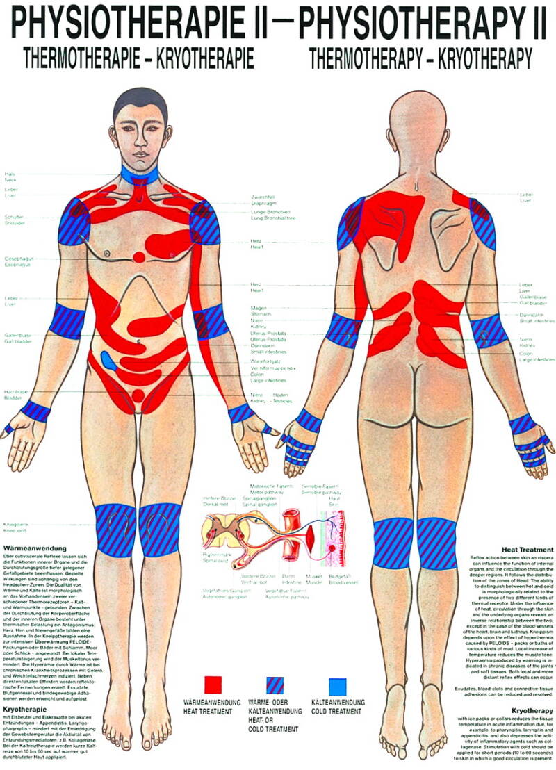 Lehrtafel, Physiotherapie II, Thermo - Kryotherapie – Hauptansicht
