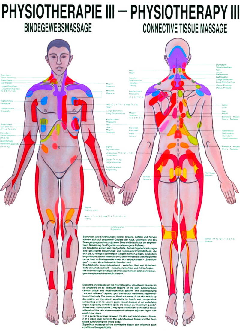 Lehrtafel, Physiotherapie III, Bindegewebsmassage – Hauptansicht